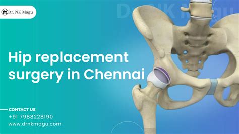 Hip Replacement Surgery Cost in Chennai | Medsurge India