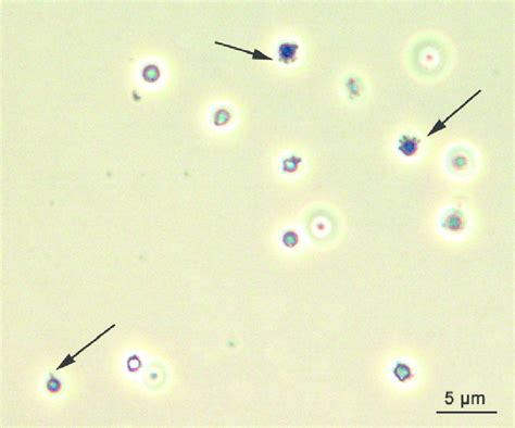 Coculture of Nanoarchaeum equitans and Ignicoccus sp. KIN4/1. Phase... | Download Scientific Diagram