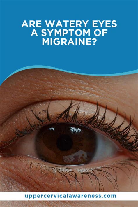 Are Watery Eyes a Symptom of Migraine?