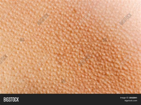 Goosebumps Skin Background Image & Photo | Bigstock