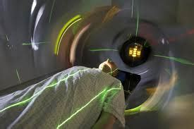 Radiotherapy side effects-Top 5 side effects of radiotherapy.