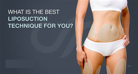 Liquid Liposuction vs. Traditional Liposuction