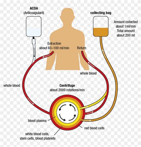 Apherese Schaubild - Apheresis Stem Cell Donation, HD Png Download - 1754x1240(#5136613) - PngFind