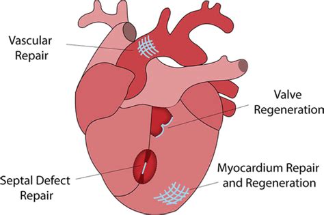 Current Applications of Polycaprolactone as a Scaffold Material for Heart Regeneration | ACS ...