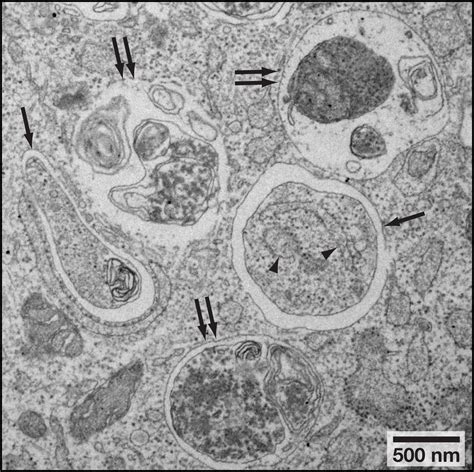 Methods in Mammalian Autophagy Research: Cell