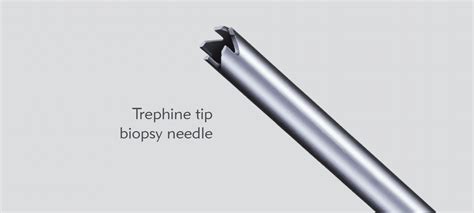 Huntington™ Bone Biopsy System - Guided & Perforating Biopsy System