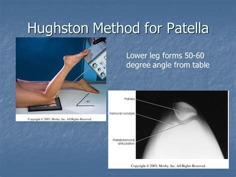 Radiographic Positioning Examples of the Knee Patella Views - CE4RT