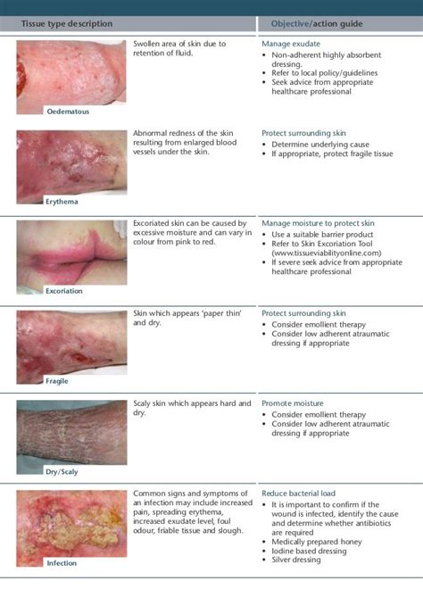 excoriated skin pictures - Google Search | Wound Care | Pinterest ...