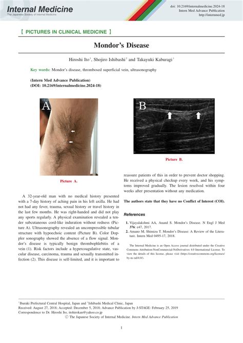 (PDF) Mondor's Disease