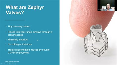 Zephyr Valve 101: Understanding Lung Valve Basics - YouTube