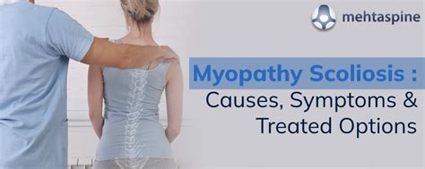 Myopathy Scoliosis Diagnosed and Treated | Mr Jwalant S Mehta