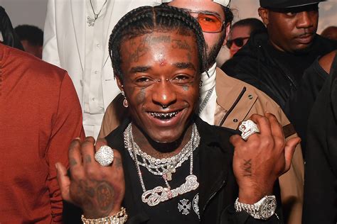 Lil Uzi Vert Diamond Implant, Lil Uzi Vert Says Fans Ripped 24 Million Diamond Out Of His ...