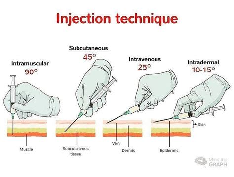 Injection technique : r/coolguides