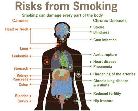 Smoking – Ashcroft Surgery (Bradford, UK)