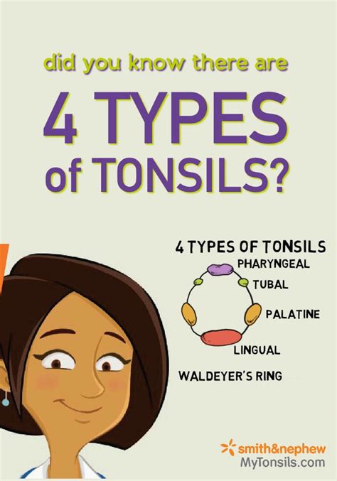 4 Types of Tonsils | Tonsils and adenoids, Human digestive system, Palatine