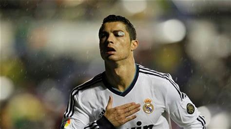 Cristiano Ronaldo Sidelined with Eye Injury | Fox News