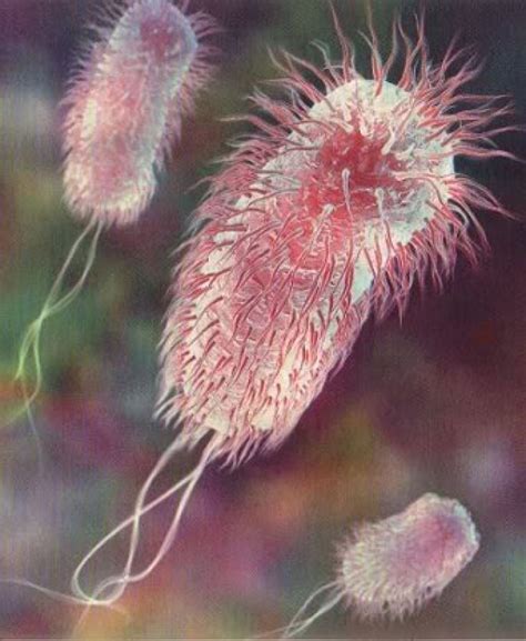 Escherichia coli O157:H7 | Medicine/Mycro/Infectology Public Health i…