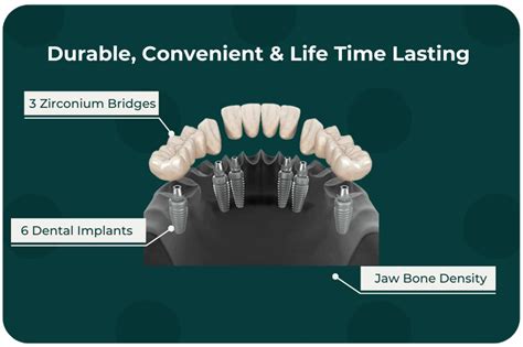 3 On 6 Dental Implant System - allondental.com