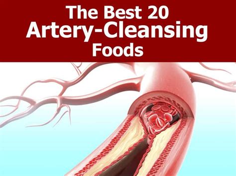 The Best 20 Artery-Cleansing Foods | Health, Natural health remedies, Anti cancer