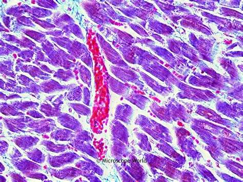 Microscope World Blog: Human Cardiac Muscle under the Microscope