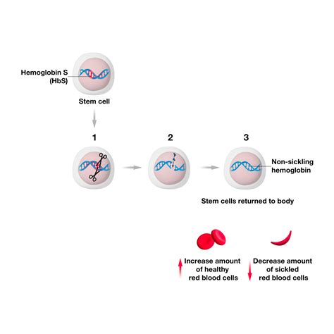 Understanding gene therapy approaches