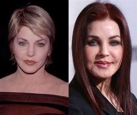 Priscilla Presley Plastic Surgery Went Horribly Wrong