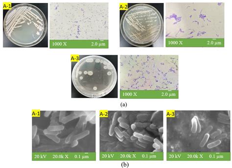 Morphological observation of bacillus: colony and cell morphology of ...