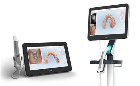 iTero® 5D Plus Digital Scanner - Dunavin Dental