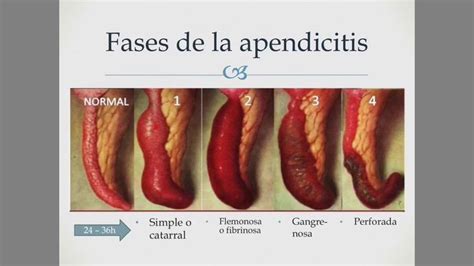 Pin en Gastroenterología