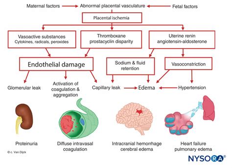 Obstetric Regional Anesthesia - NYSORA | NYSORA