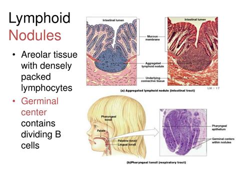 PPT - Chapter 20, 21. Lymphatic and Immune Systems PowerPoint ...