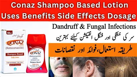 Conaz Shampoo Benefits In Urdu | Conaz Lotion Shampoo Based | conaz ...