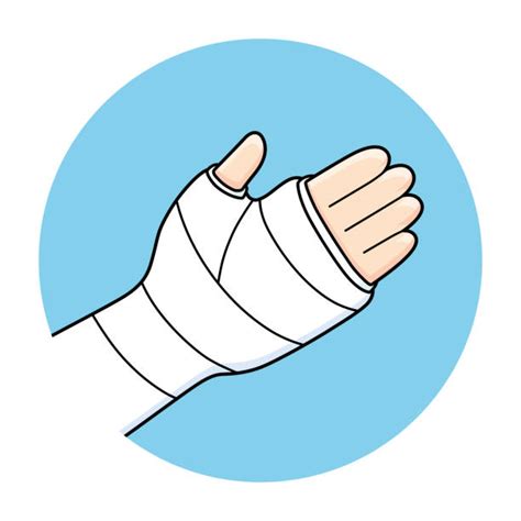 Broken Arm Cartoons Illustrations, Royalty-Free Vector Graphics & Clip Art - iStock