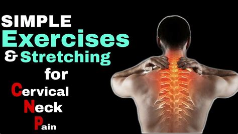 Cervical Neck Pain Relief Exercises and Stretching - YouTube