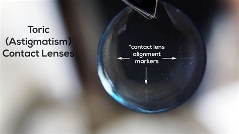 Did you know contact lenses for #astigmatism have little alignment markers for your doctor to ...
