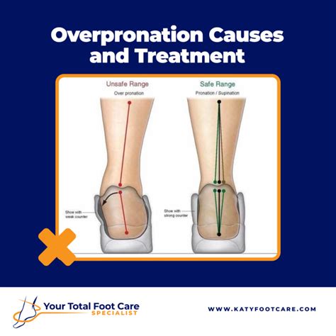 Overpronation Causes and treatment