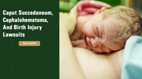 Caput Succedaneum, Cephalohematoma, and Birth Injury Lawsuits