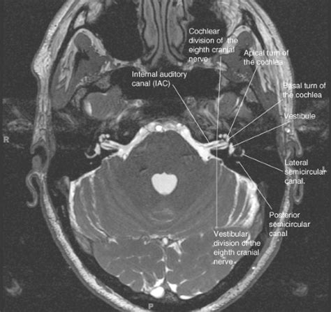 Introduction to Brain Imaging | Radiology Key