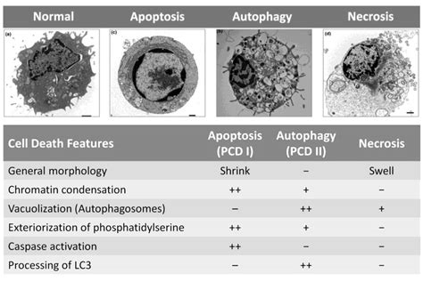 Apoptosis Electron Microscopy