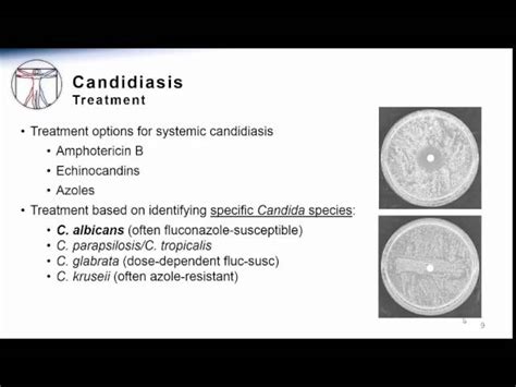 Candidiasis Treatment