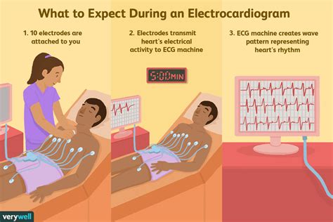 Electrocardiogram (ECG or EKG): Procedure and Results