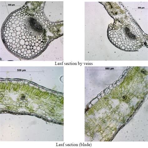 Mertensia sibirica rosette and cauline leaf blade anatomy respectively. | Download Scientific ...