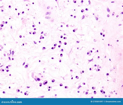 Plasma cells stock image. Image of blood, immunity, lymphocyte - 270581097