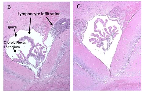 Choroid Plexus Brain Model