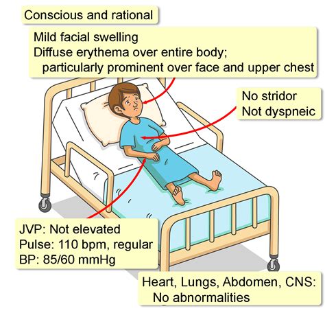 Scombroid Fish Poisoning - Interactive case study | Clinical Odyssey by ...