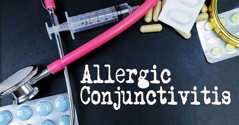 Allergic Conjunctivitis: Causes, Symptoms, and Treatments - Facty Health