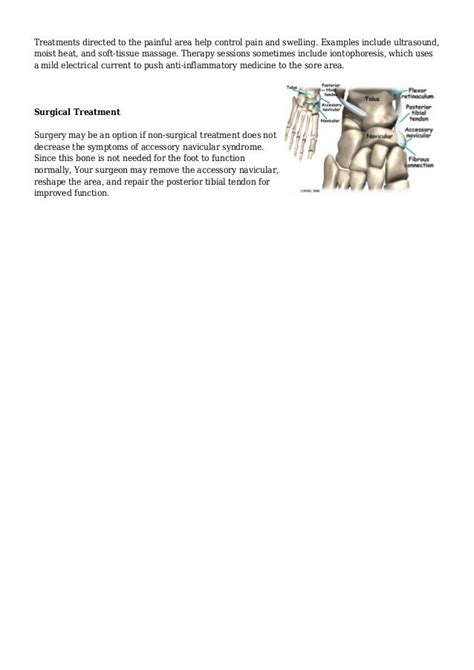 Recovery From Accessory Navicular Bone Removal