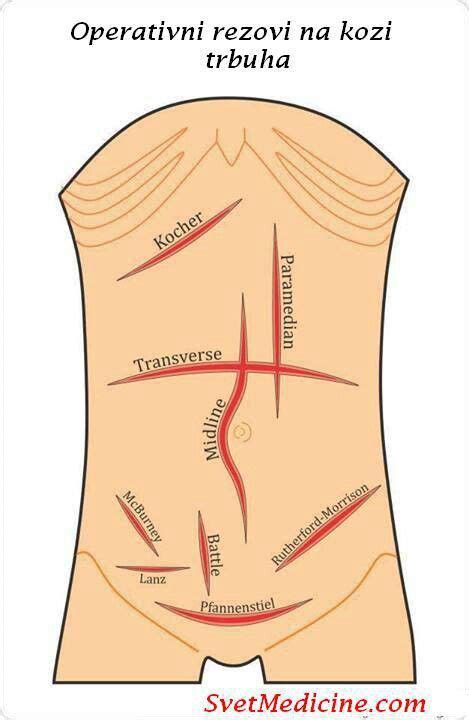 Surgical incisions. Why was this so hard to learn?! | OR nursing | Pinterest | The old ...