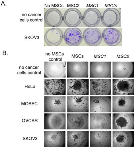 A. Representative micrographs from colony forming units (CFU) assays ...