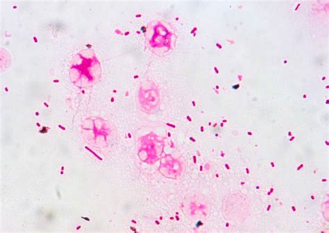 Enterobacter cloacae〔エンテロバクター・クロアカ〕 | グラム染色: Gram Stain